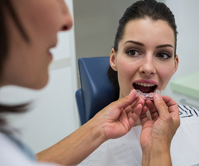 Invisalign